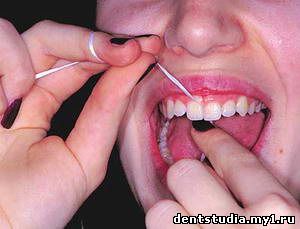 флосс вводят в промежуток между зубами